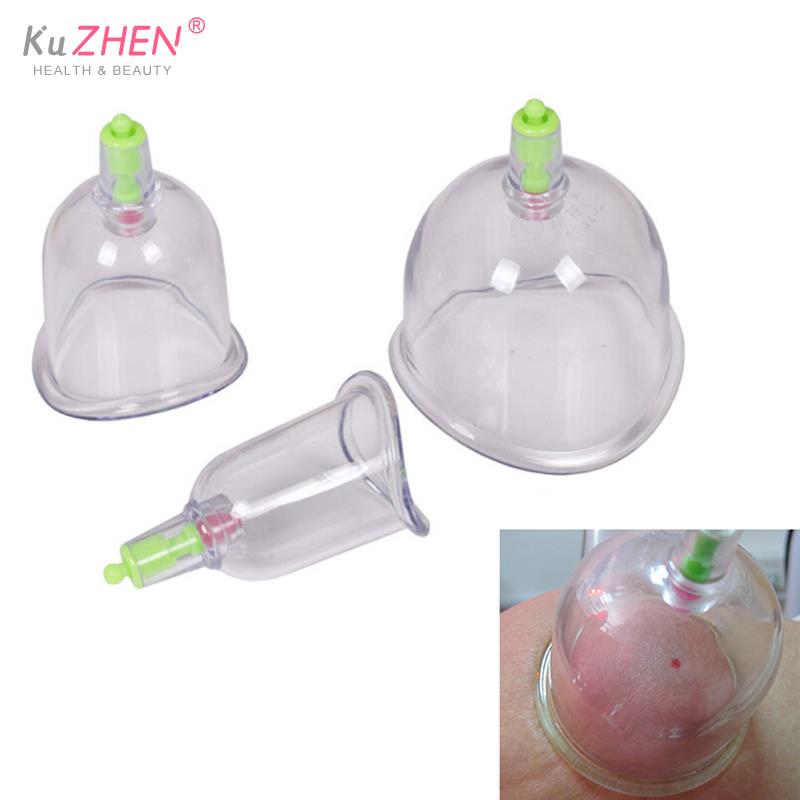 Tradisional 3 Cangkir Kangzhu  - Medical Lab Science ulasan dan harga